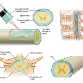 Injectable Hydrogels